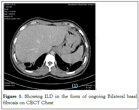 rheumatology-Bilateral basal